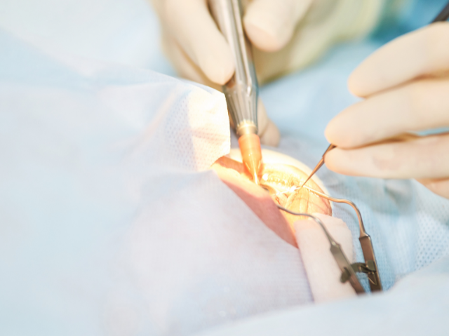 cataract surgery in ambala